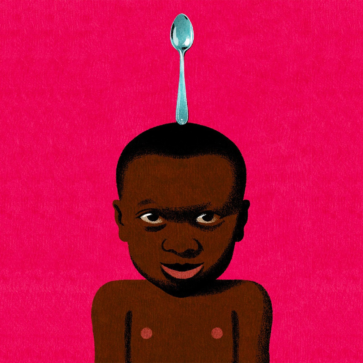 Trattamento per un Bambino Malnutrito